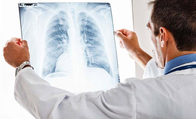 doctor reviewing xrays of chest
